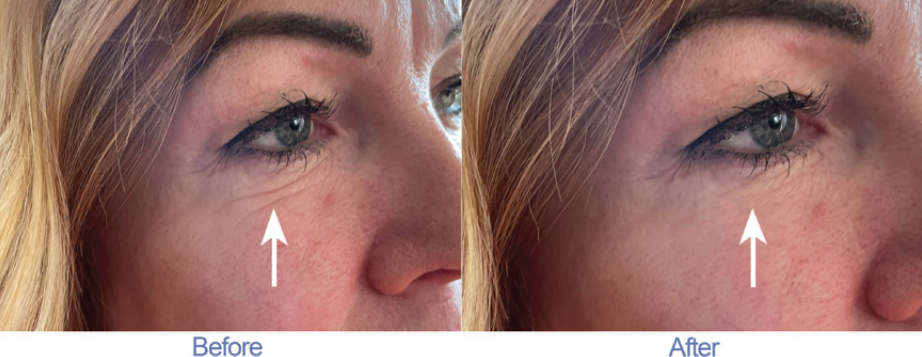 2 Minute Cream Before and After Testimonial 1
