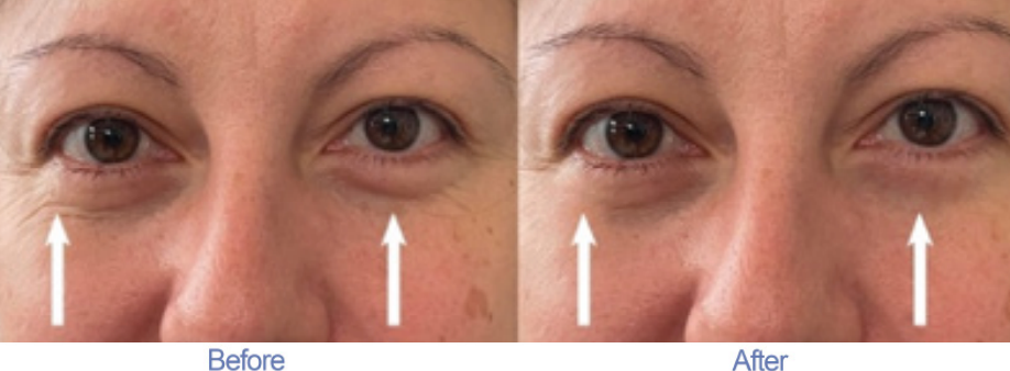 2 Minute Cream Before and After Testimonial 4